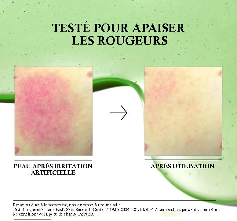 ANUA Azelaic Acid + 10 Hyaluron Serum