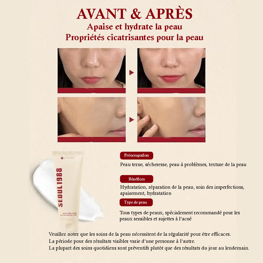 de mucine d’escargot