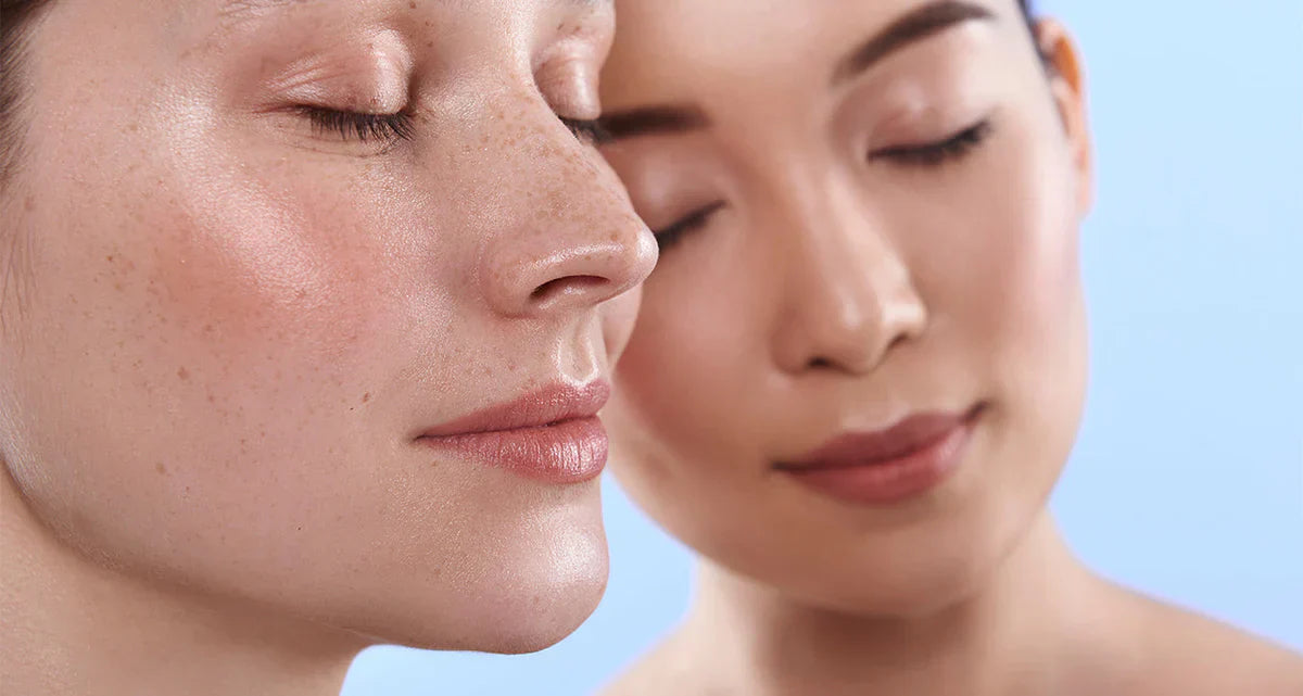 peau sensible au printemps