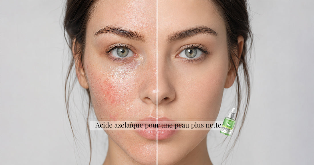 sérum à l'acide azélaïque Anua