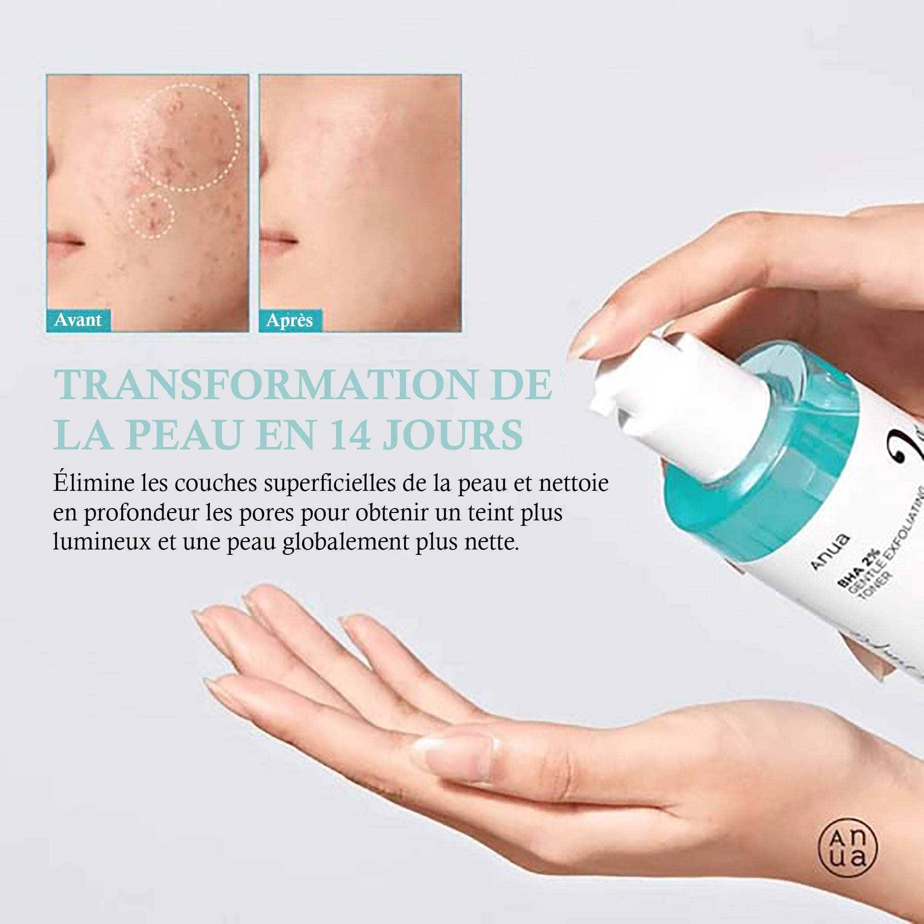 Anua – Tonique Exfoliant Doux BHA 2%
