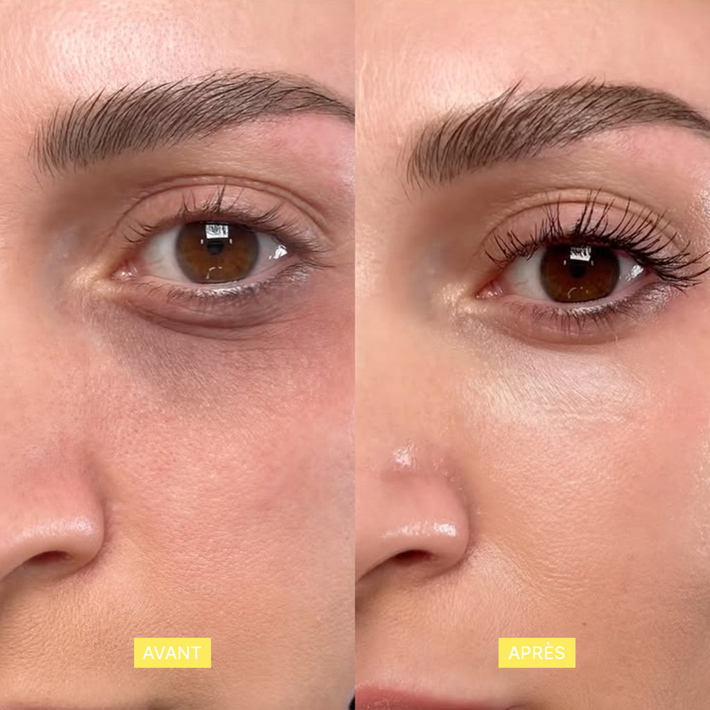 Soin_contour_des_yeux_caféine_et_curcumam
