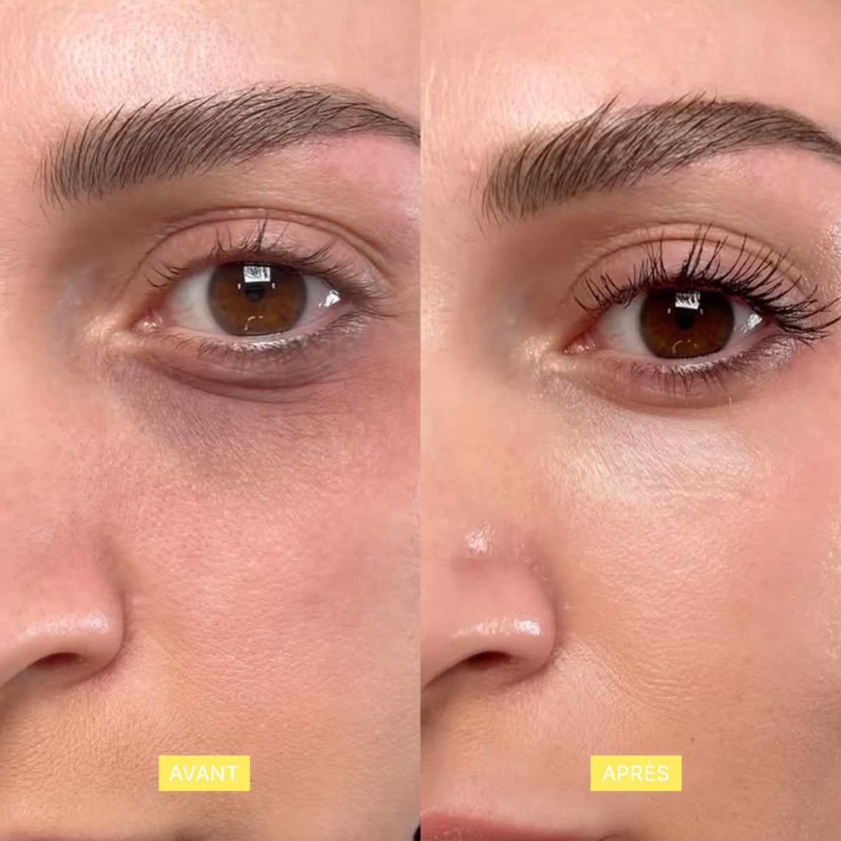 Soin_contour_des_yeux_caféine_et_curcumam