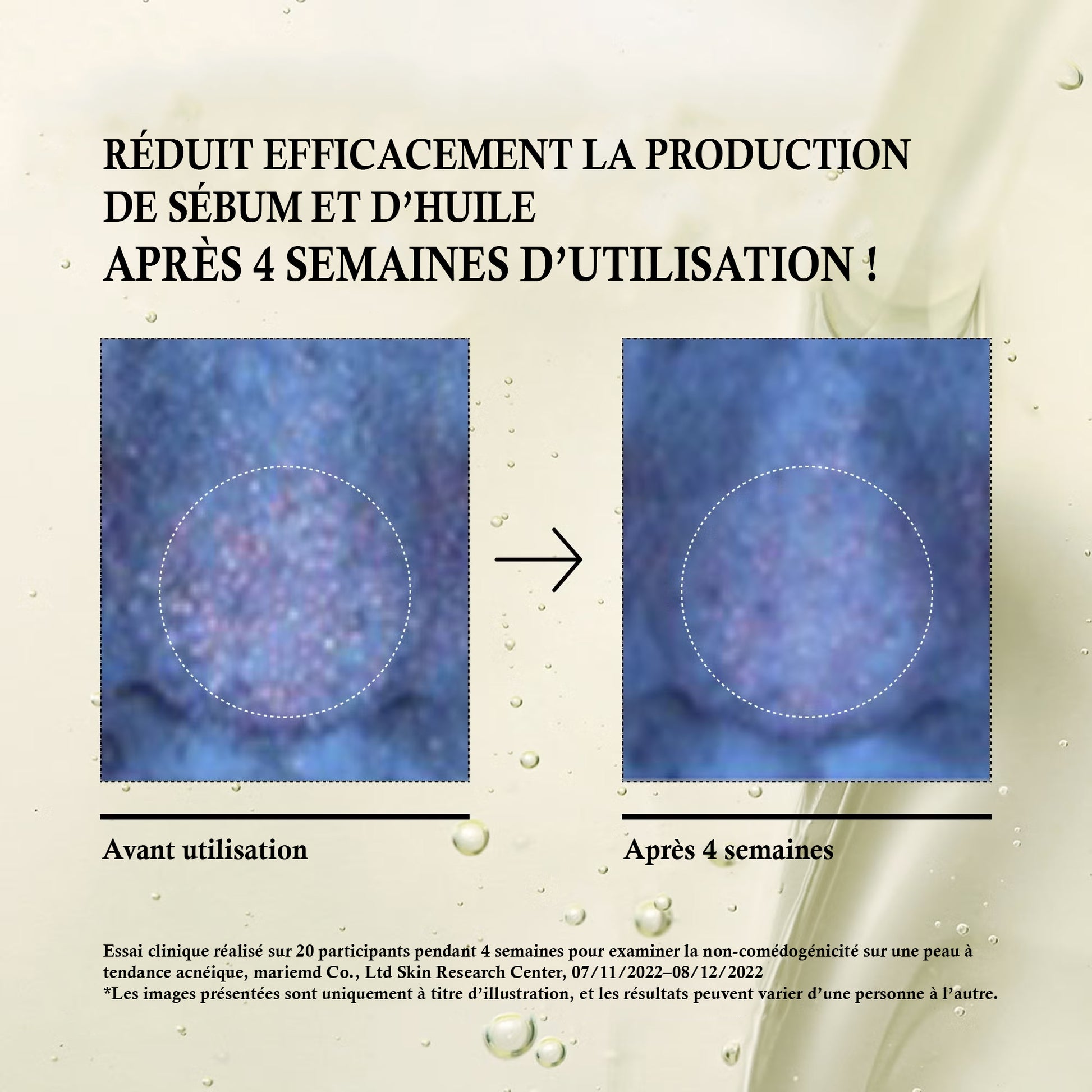 Résultats Anua réduction sébum après 4 semaines