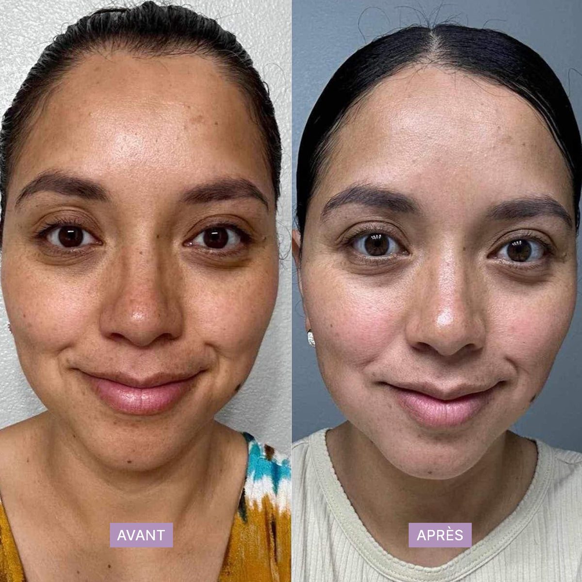 DERMI PHYTO-RETINOL