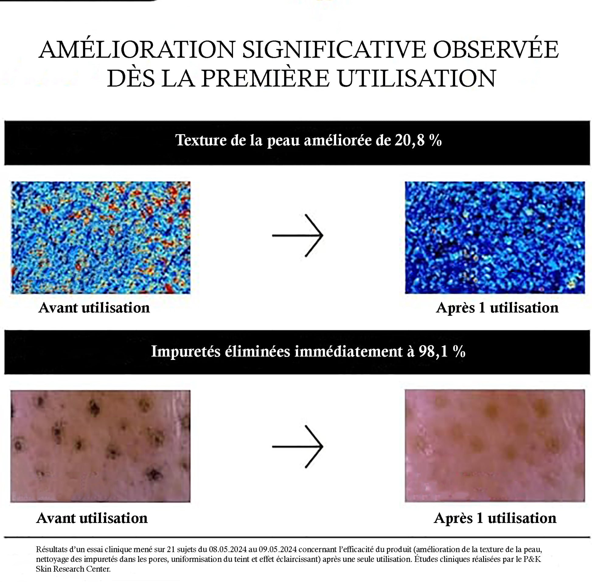 Anua – Poudre Nettoyante Éclaircissante aux Enzymes de Riz