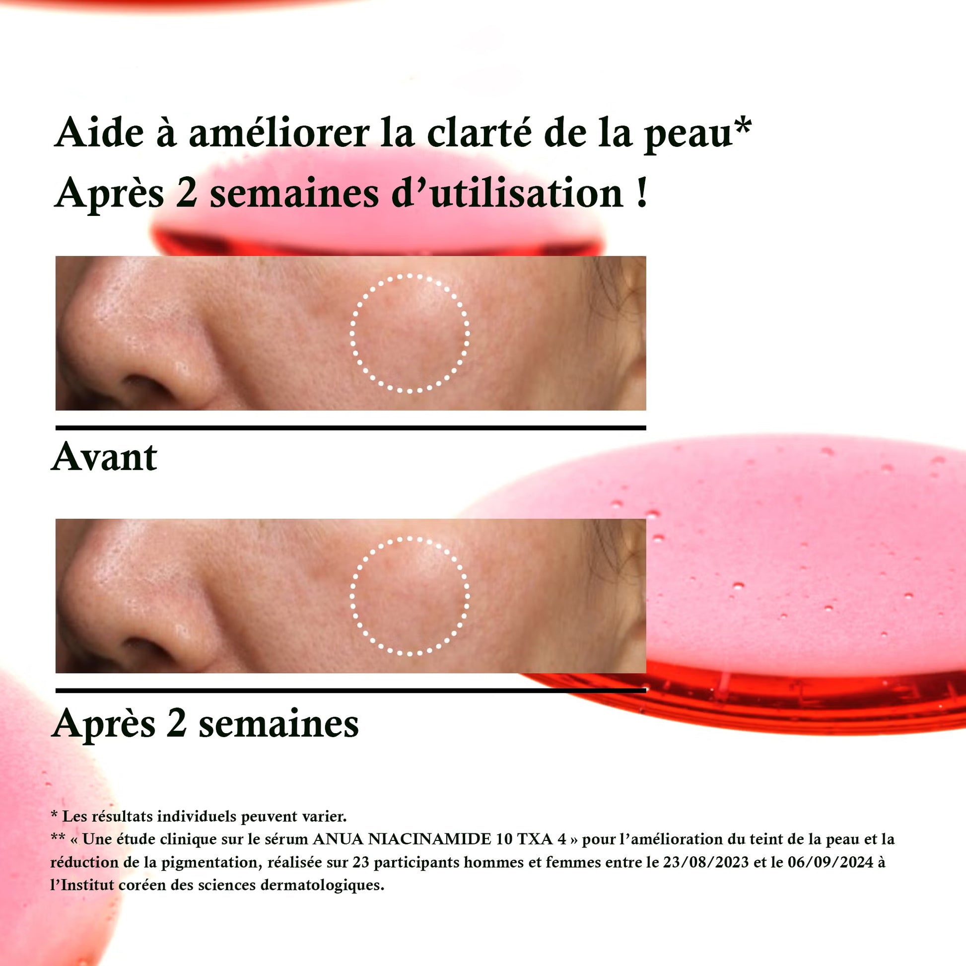 ANUA Niacinamide 10 + TXA 4%