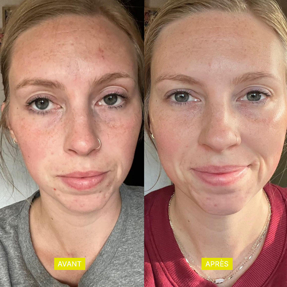 DERMI VITA GLOW
