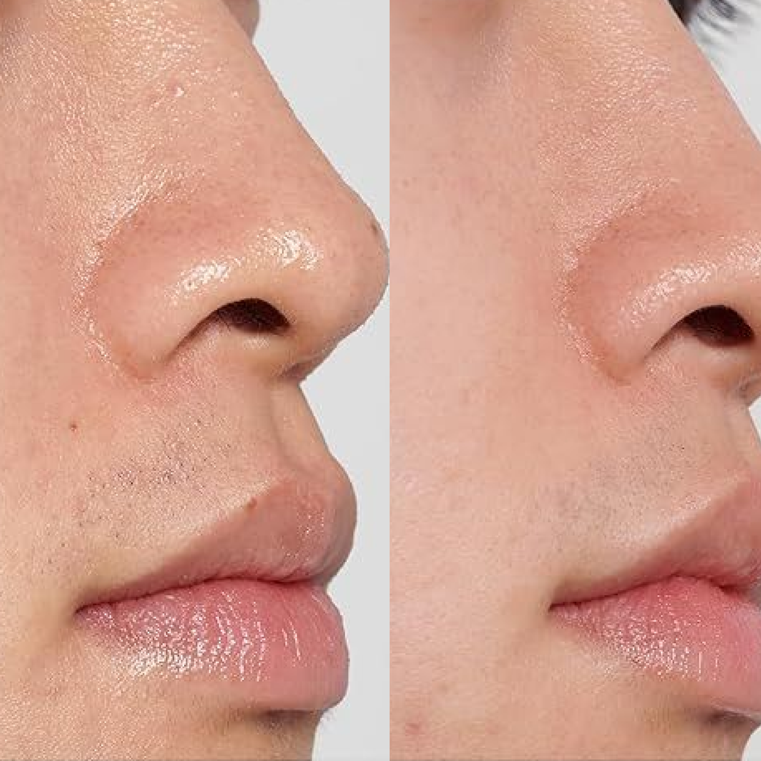 Skincare Coréenne