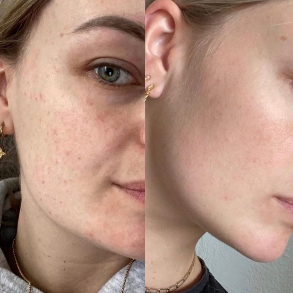 Potential Treatments