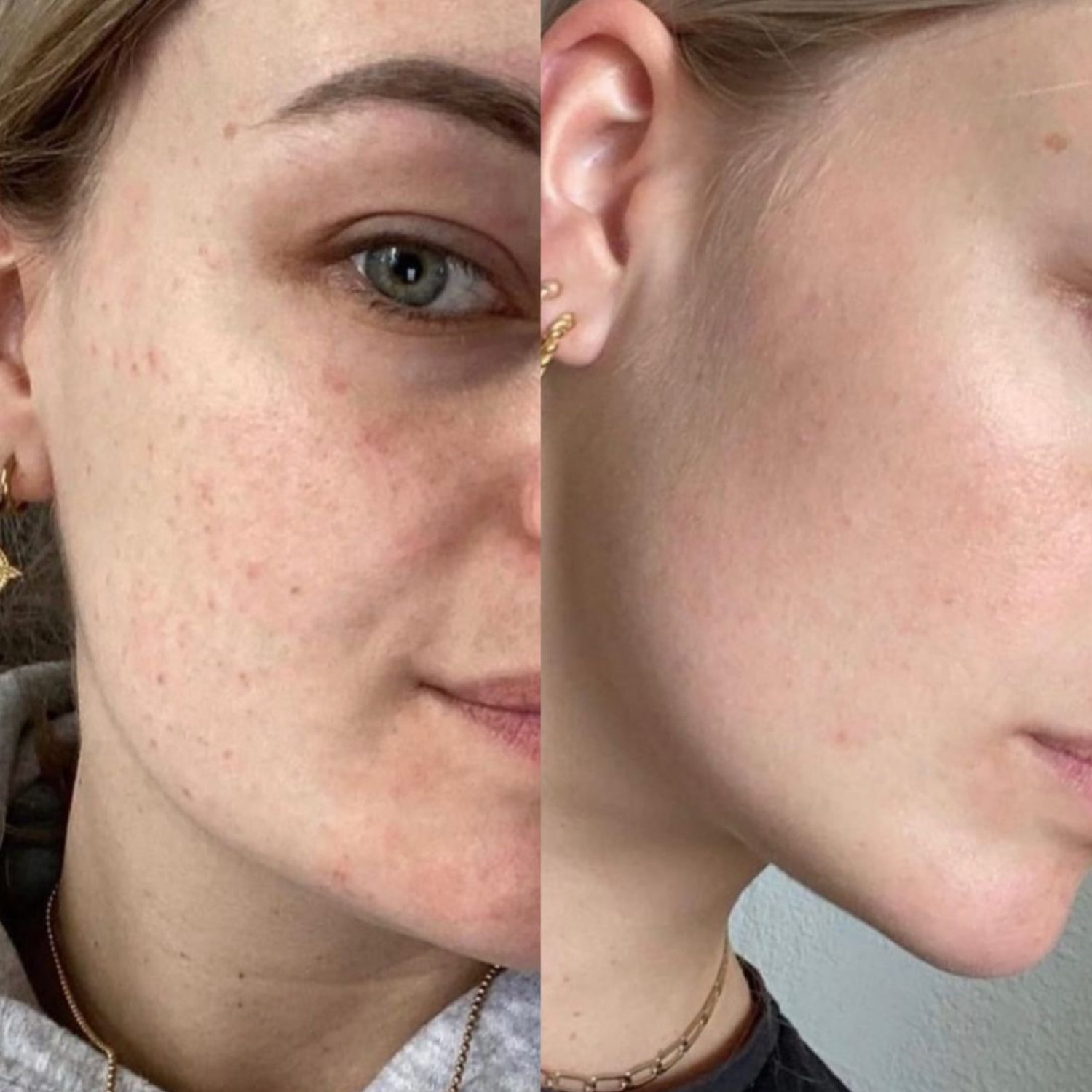 Potential Treatments